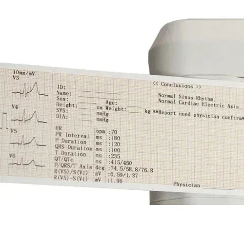 3 Channel ECG Machine with High Quality Waveforms - #1 Physiotherapy Equipment Manufacturers & Suppliers in India