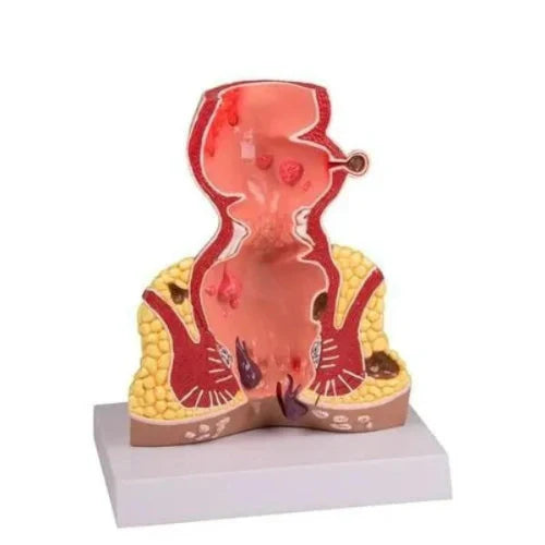 Anatomical model of a human body cut open on a white background