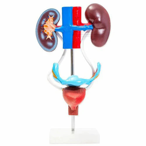 Model of a kidney and urinary system on a white background