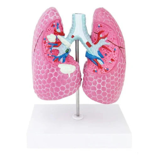 Model of pink lungs with anatomical details on a white background